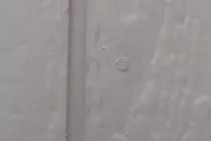 Nail Pops: What To Know